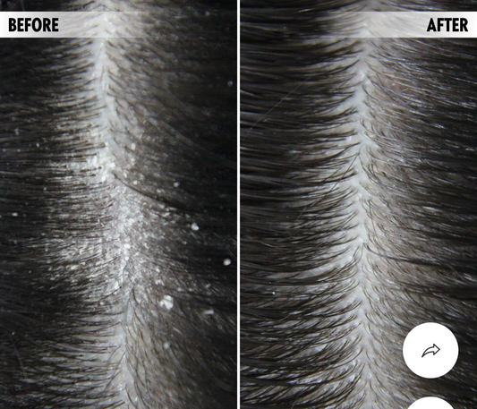 Anti-Flake Purifying Scalp Scrub